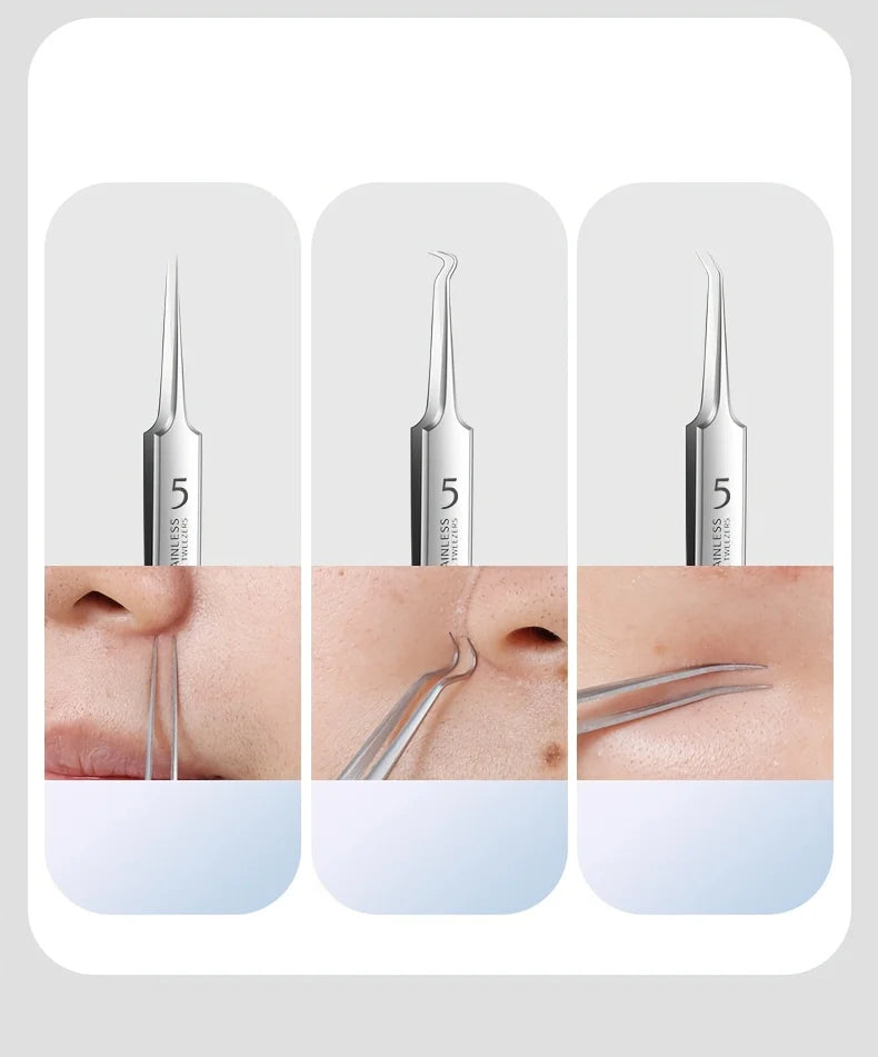 Stainless Steel 4/7/8pcs Acne Removal Tool Set - Blackhead & Pimple Popper Kit for All Skin Types, Fragrance-Free, Beauty Tools