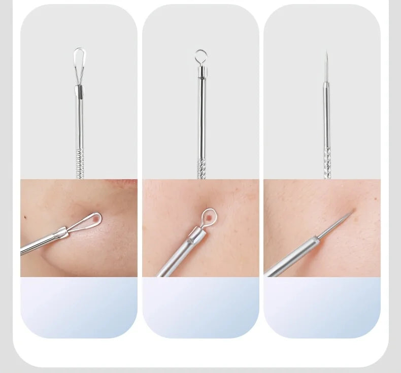 Stainless Steel 4/7/8pcs Acne Removal Tool Set - Blackhead & Pimple Popper Kit for All Skin Types, Fragrance-Free, Beauty Tools
