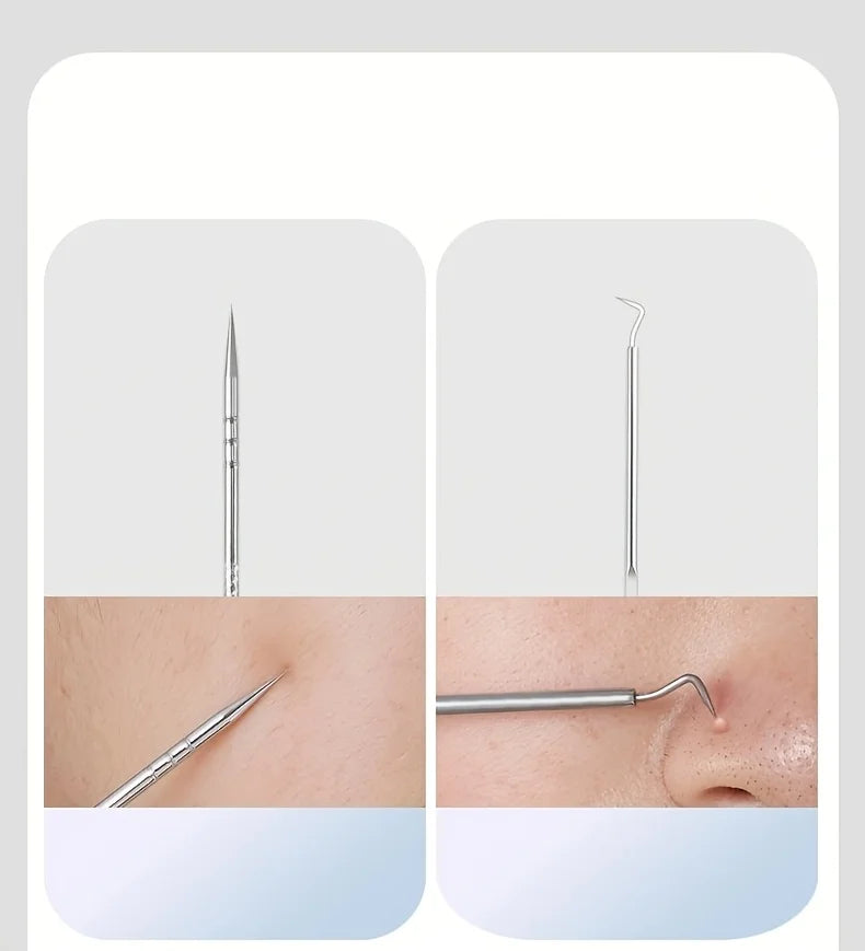 Stainless Steel 4/7/8pcs Acne Removal Tool Set - Blackhead & Pimple Popper Kit for All Skin Types, Fragrance-Free, Beauty Tools