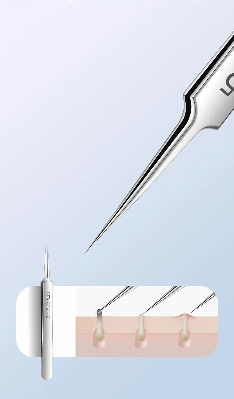 Stainless Steel 4/7/8pcs Acne Removal Tool Set - Blackhead & Pimple Popper Kit for All Skin Types, Fragrance-Free, Beauty Tools